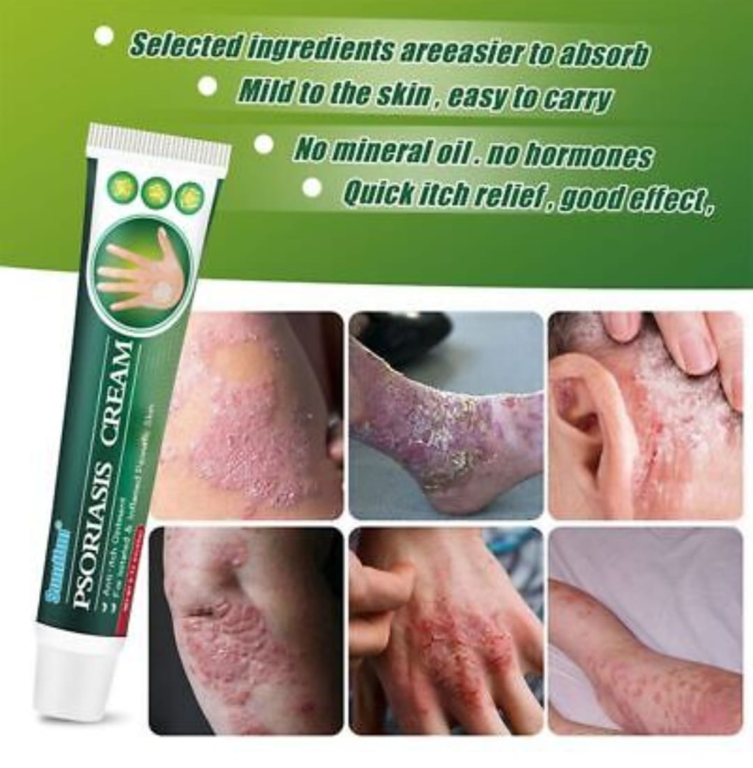 Summifun - Psoriasis Cream (Original)