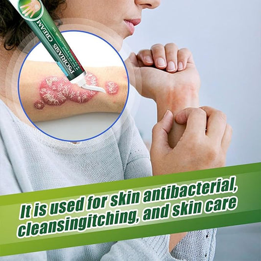 Summifun - Psoriasis Cream (Original)