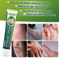 Summifun - Psoriasis Cream (Original)