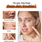 Kojic Acid Soap Skin Cleaning Facial Soap